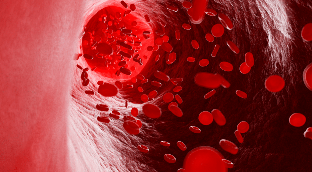 L’anemia nel paziente oncologico, come riconoscerla e come trattarla